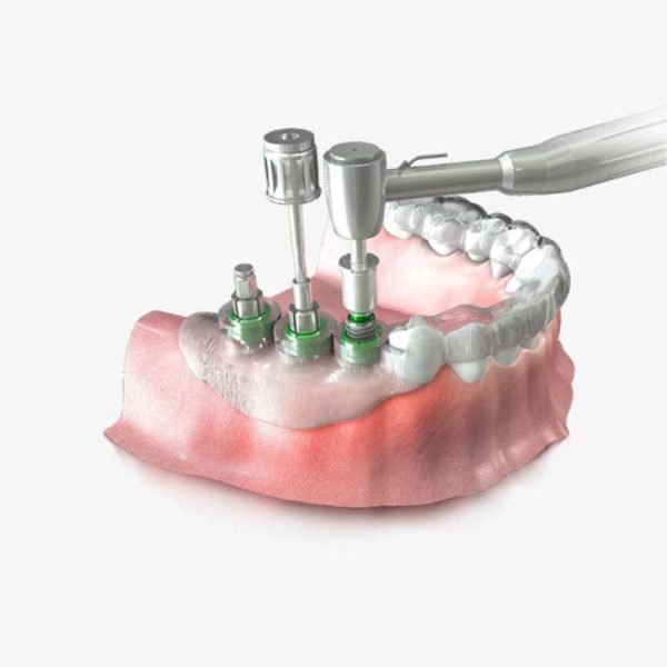 Surgical guide(dentis guide system)